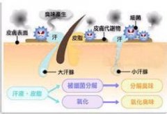 合肥腋臭医院